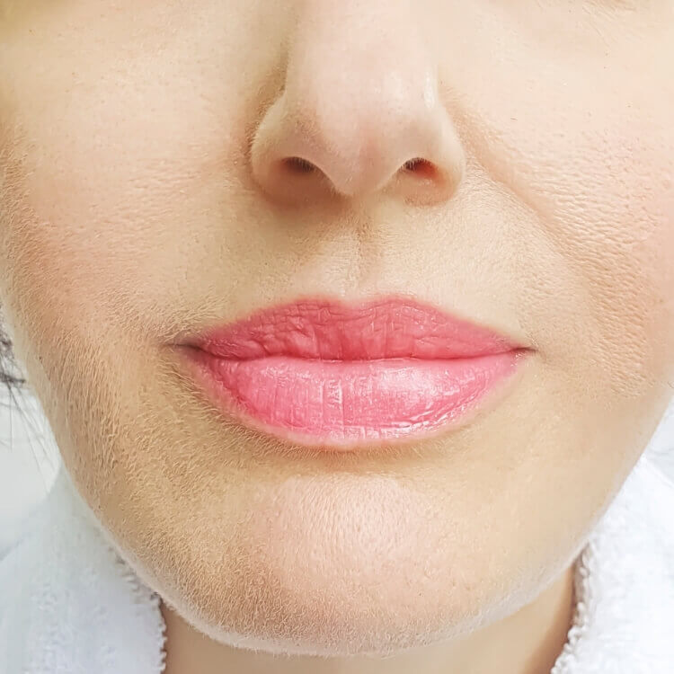 beltade lips results (1)