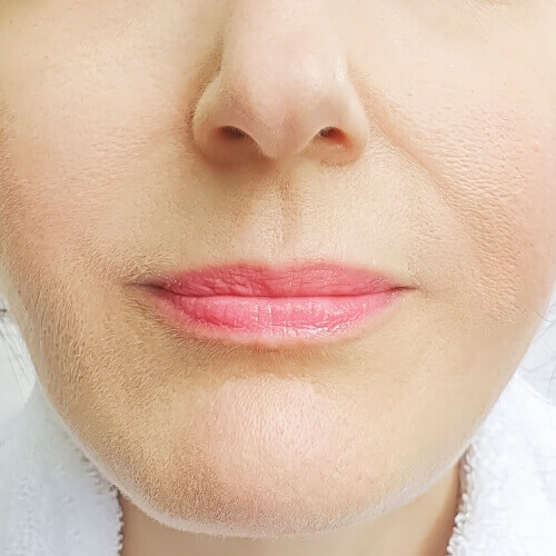 beltade lips results